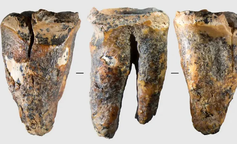 Neue Erkenntnisse über die Zahnmedizin der Neandertaler