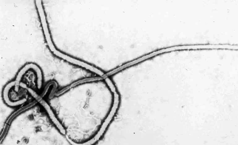 Was man über das Ebolavirus wissen sollte