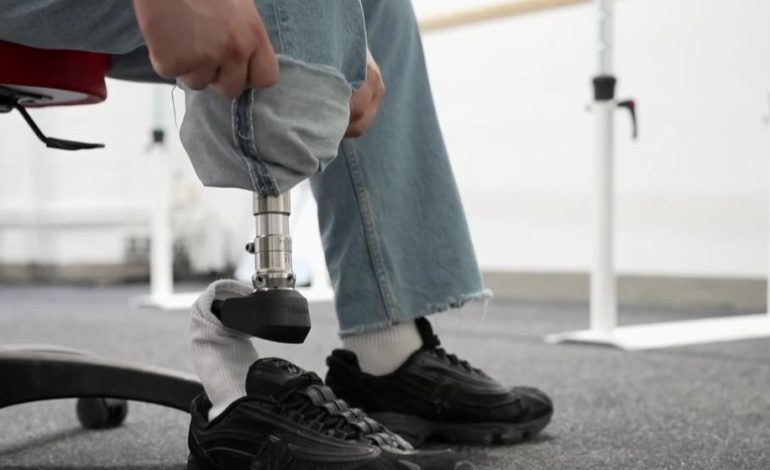 Ausbildung für ukrainische Veteranen: Vom Patienten zum Prothesenmacher