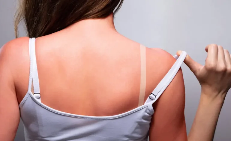 Gesundheitsgefährdender Trend: Risiken von Tanmaxxing
