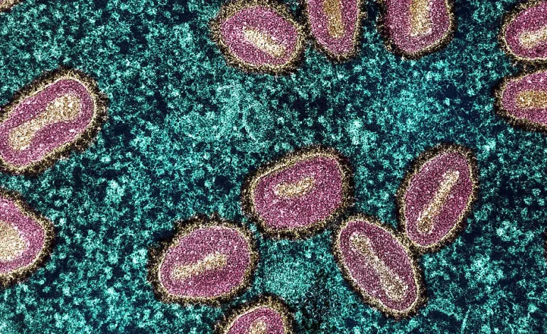 Forscher entdecken: Spermien begünstigen Mpox-Übertragung