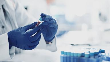 Post-Sepsis-Syndrom und seine Herausforderungen