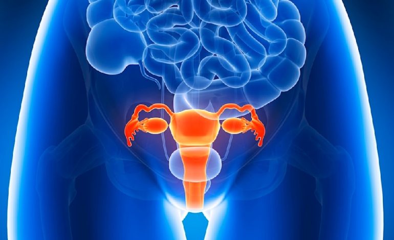 Endometriose: Verständnis und Herausforderungen
